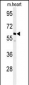 PPM1G Antibody (Center)
